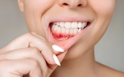 Gingivitis vs. Periodontitis: What’s the Difference?