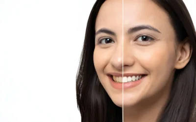 Professional vs. Store-Bought Teeth Whitening: Which Option Is Right for You?