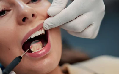 How Often Should Adults Schedule a Dental Cleaning?